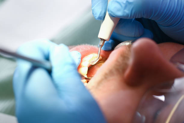 Best Emergency Gum Treatment in North Vacherie, LA